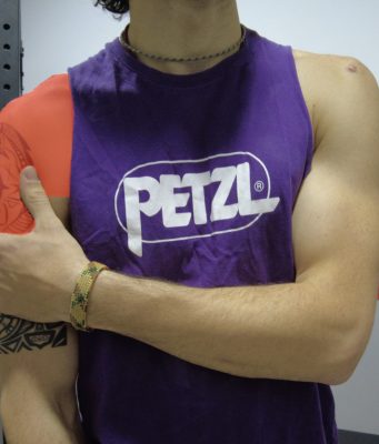 Spor Sonrası Omuz Ağrısı – Sporcular İçin Kapsamlı Omuz Ağrısı Rehberi