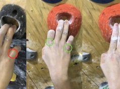 Avuç İçinde Ağrı – Lumbrical Shift Sendromu ve Tırmanış